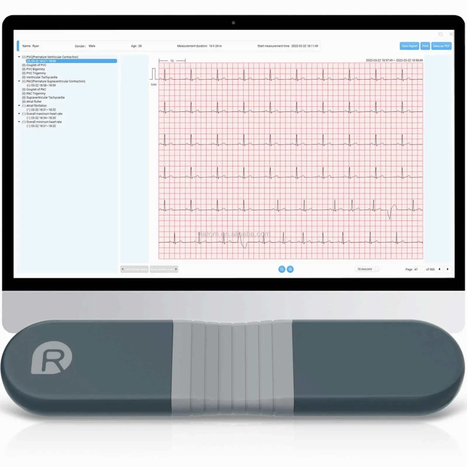 Wireless Bluetooth Dynamic Rec - Ecg Patch Monitor のレビューと価格